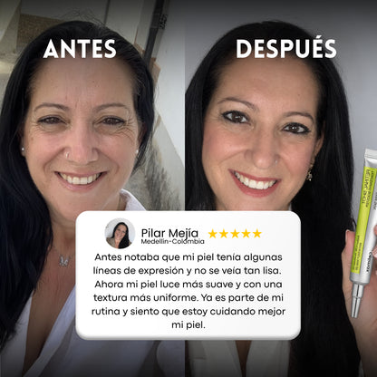 Retinal Shot Celimax para líneas de expresión y arrugas